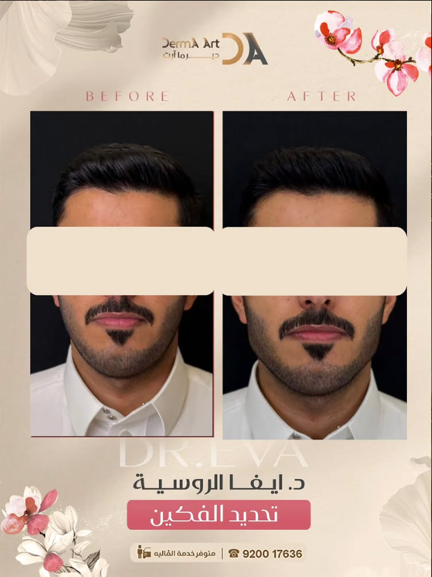 حالة قبل وبعد مع الدكتورة إيفا الروسية - الحالة 09
