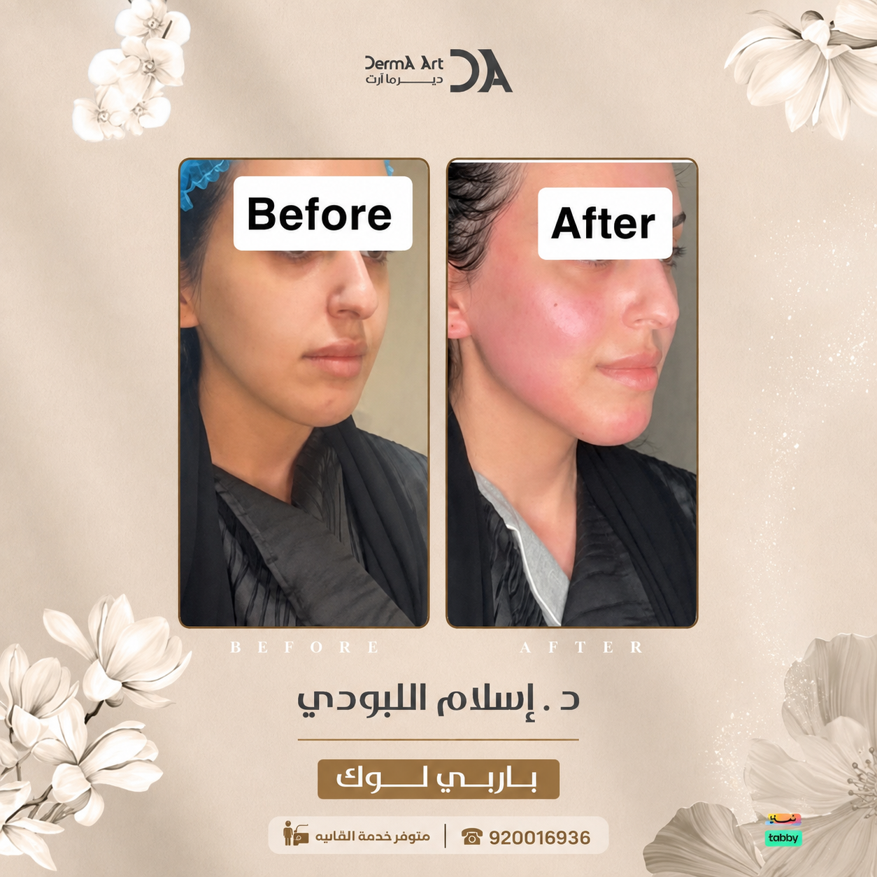كم سعر سكن بوستر بالرياض
