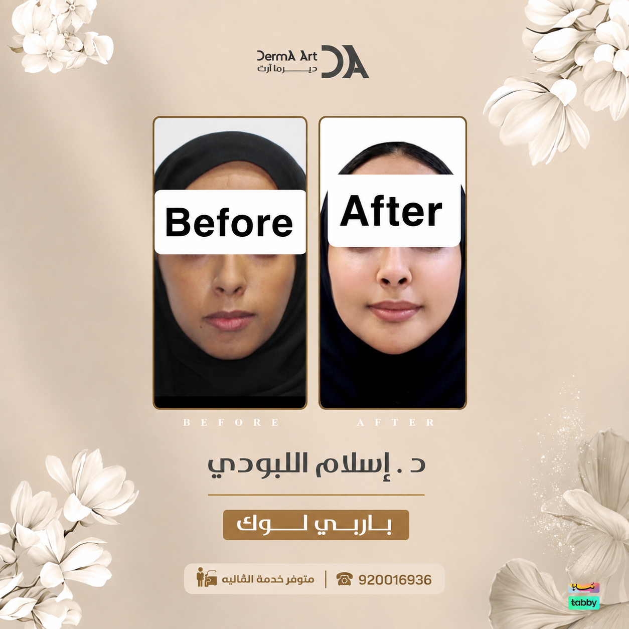 ما الفرق بين بروفايلو والفيلر؟