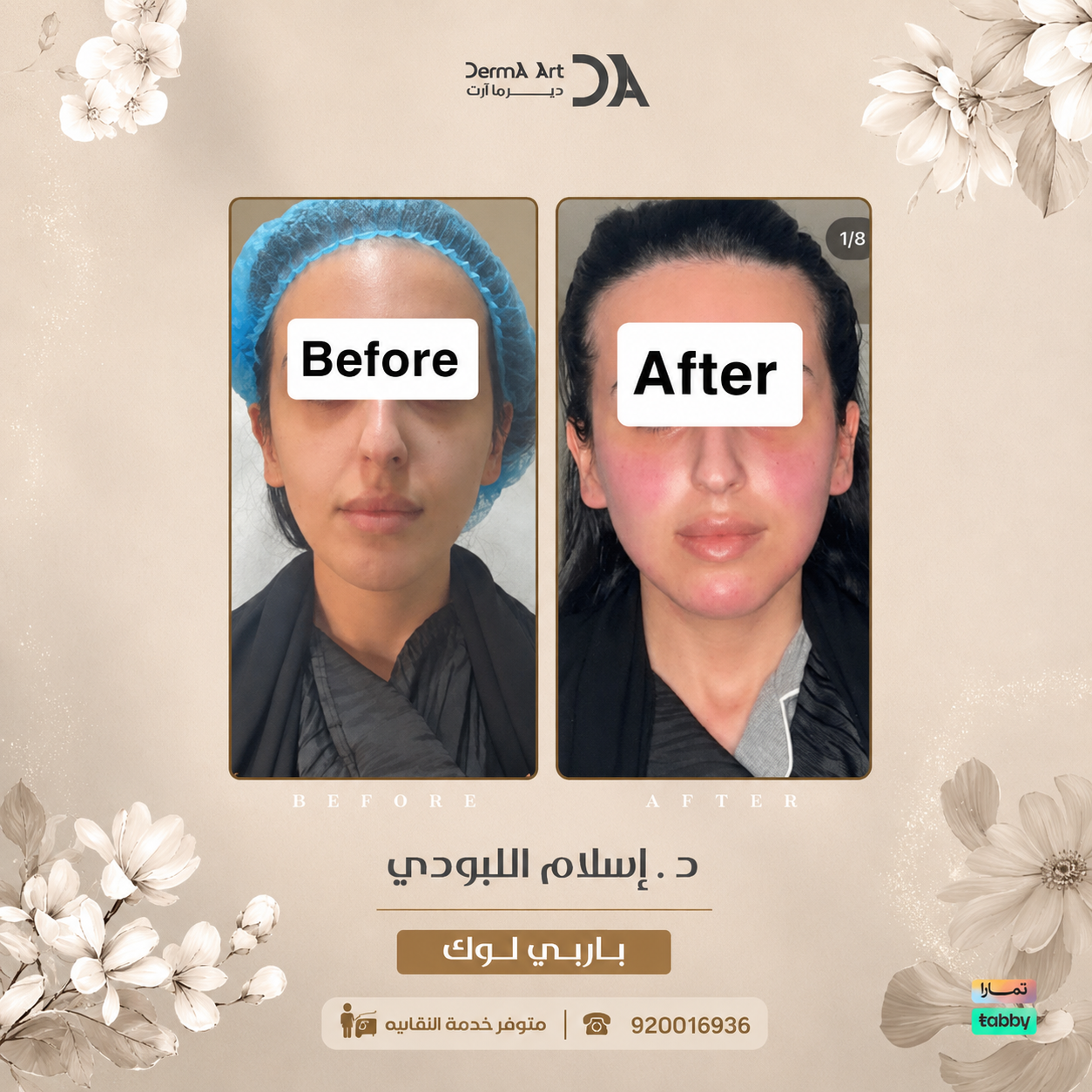 سكن بوستر بالرياض