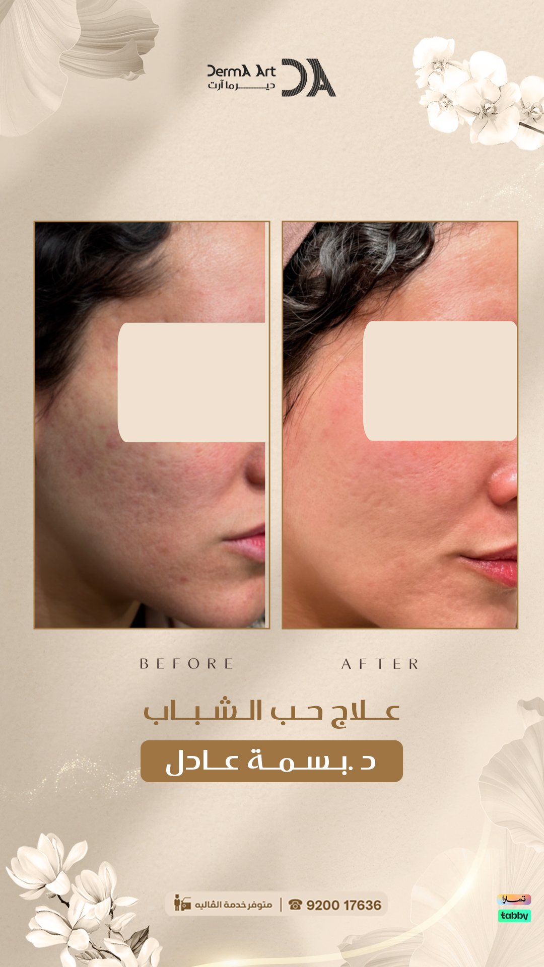 اختاري جلسة شد مائي للوجه بناءً على مشكلة البشرة