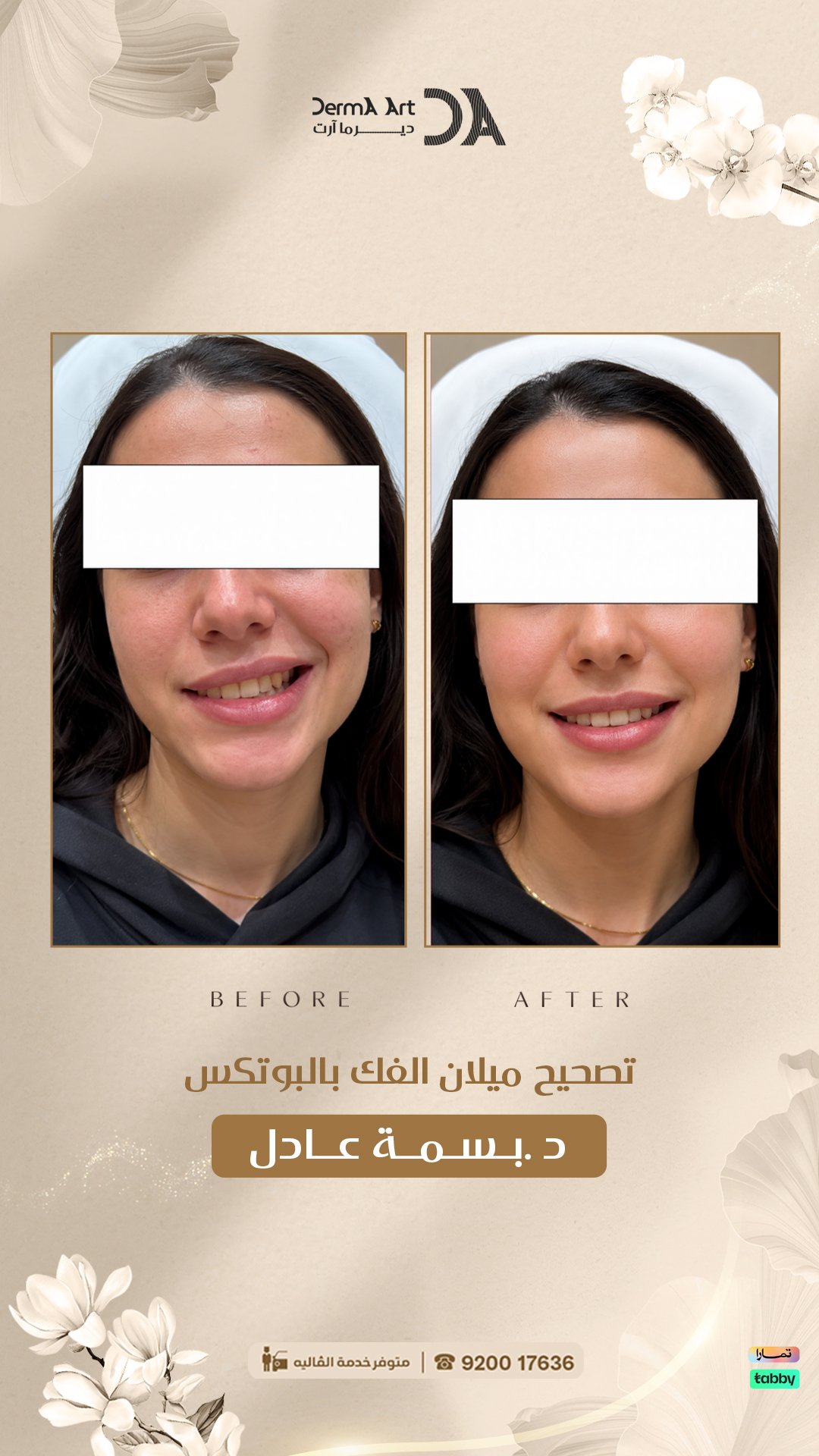 خطوات جلسة شد مائي للوجه داخل العيادة