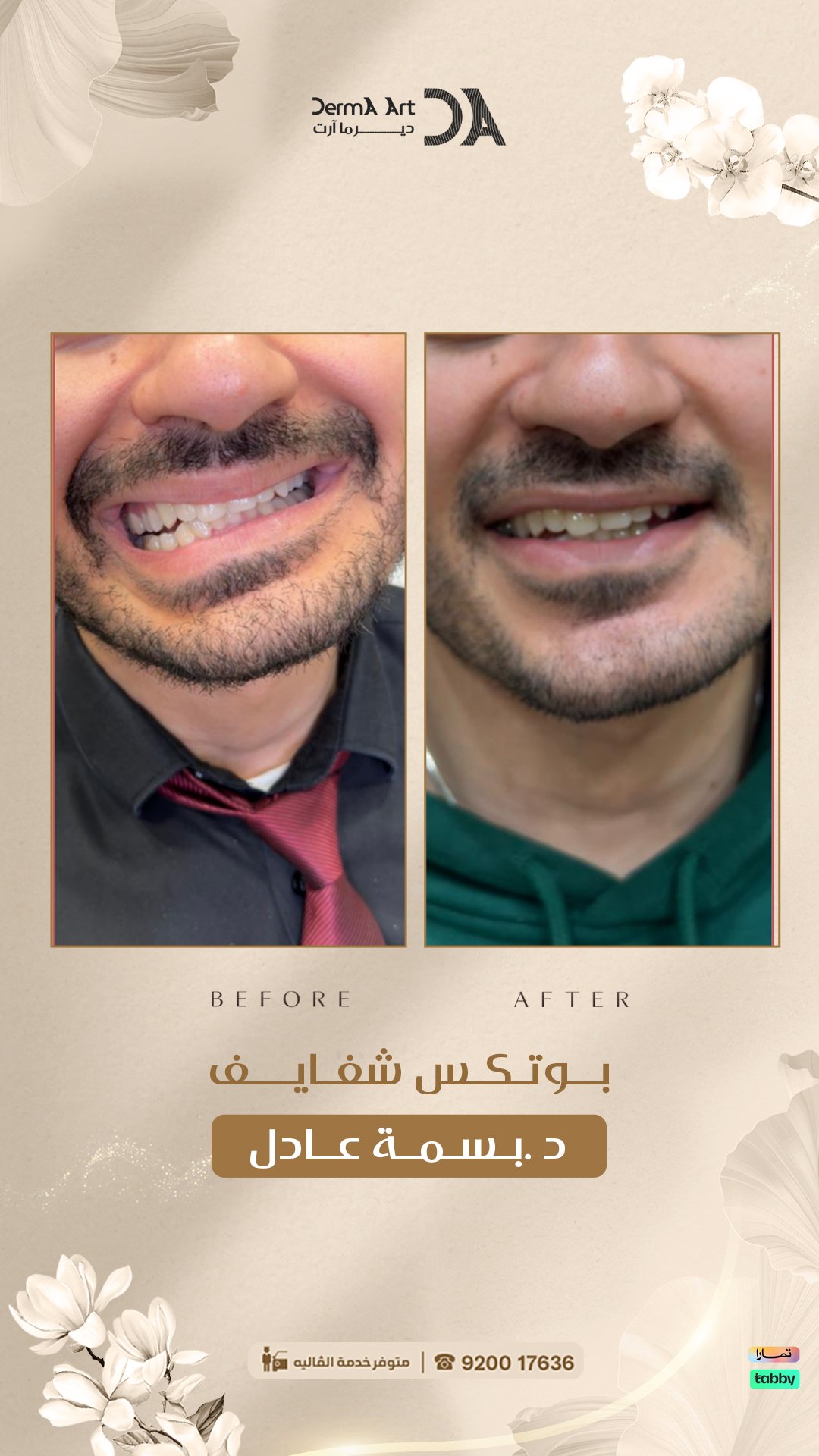 مقارنة عيادات الشد المائي بناءً على احتياجات البشرة