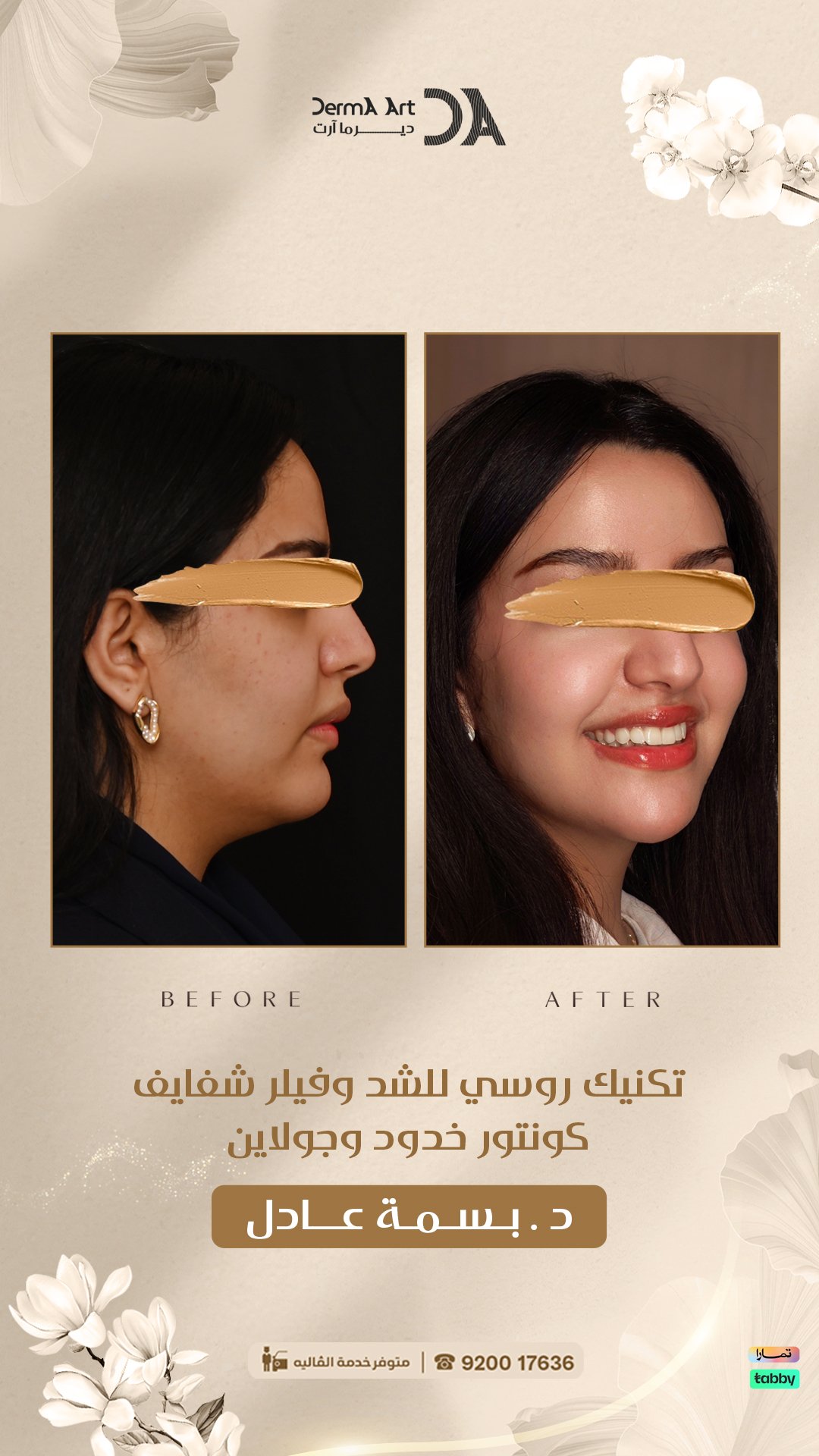 جلسة شد مائي للوجه تبدأ بتقييم البشرة وليس باختيار الجهاز