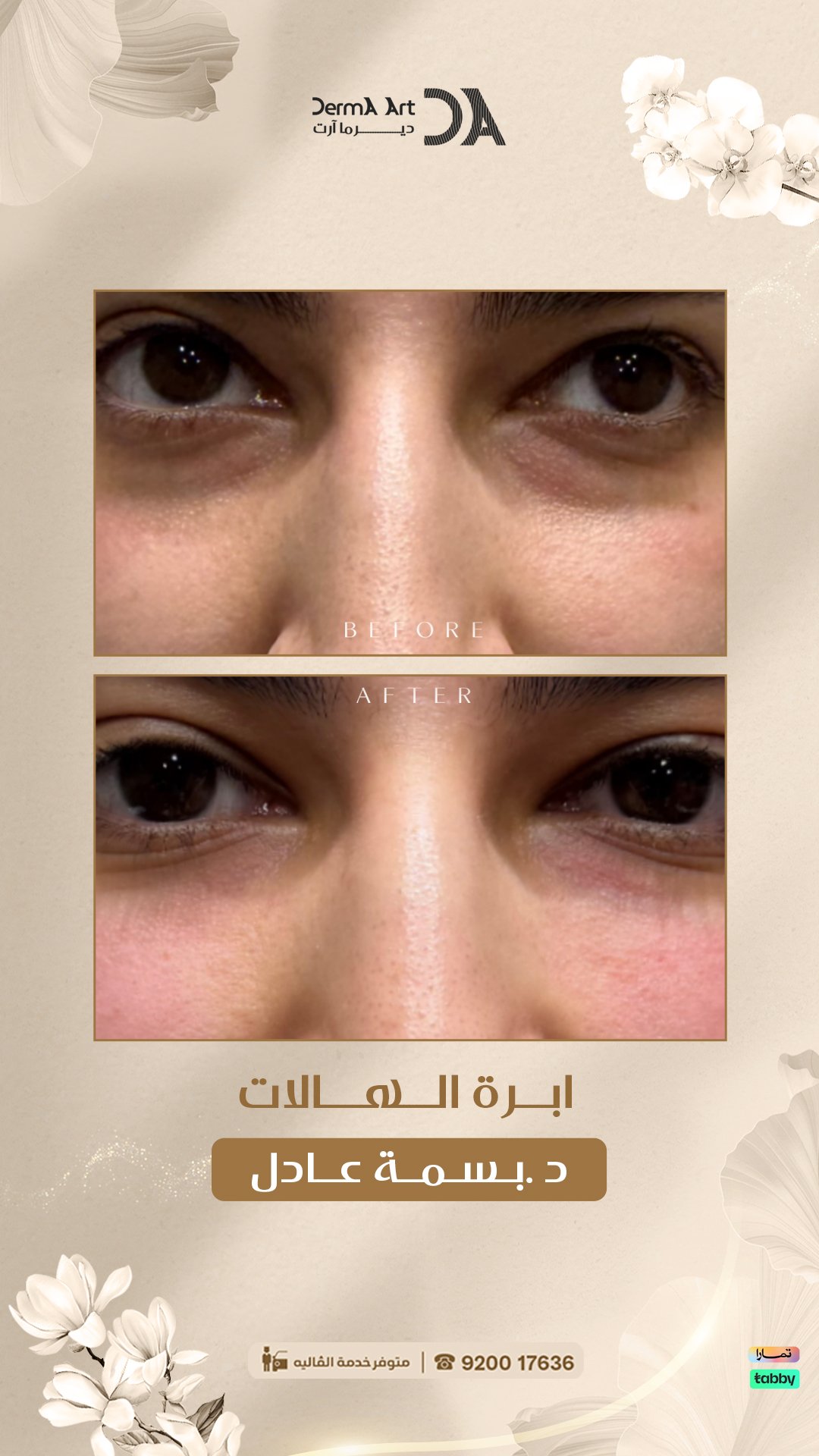 شد مائي للوجه